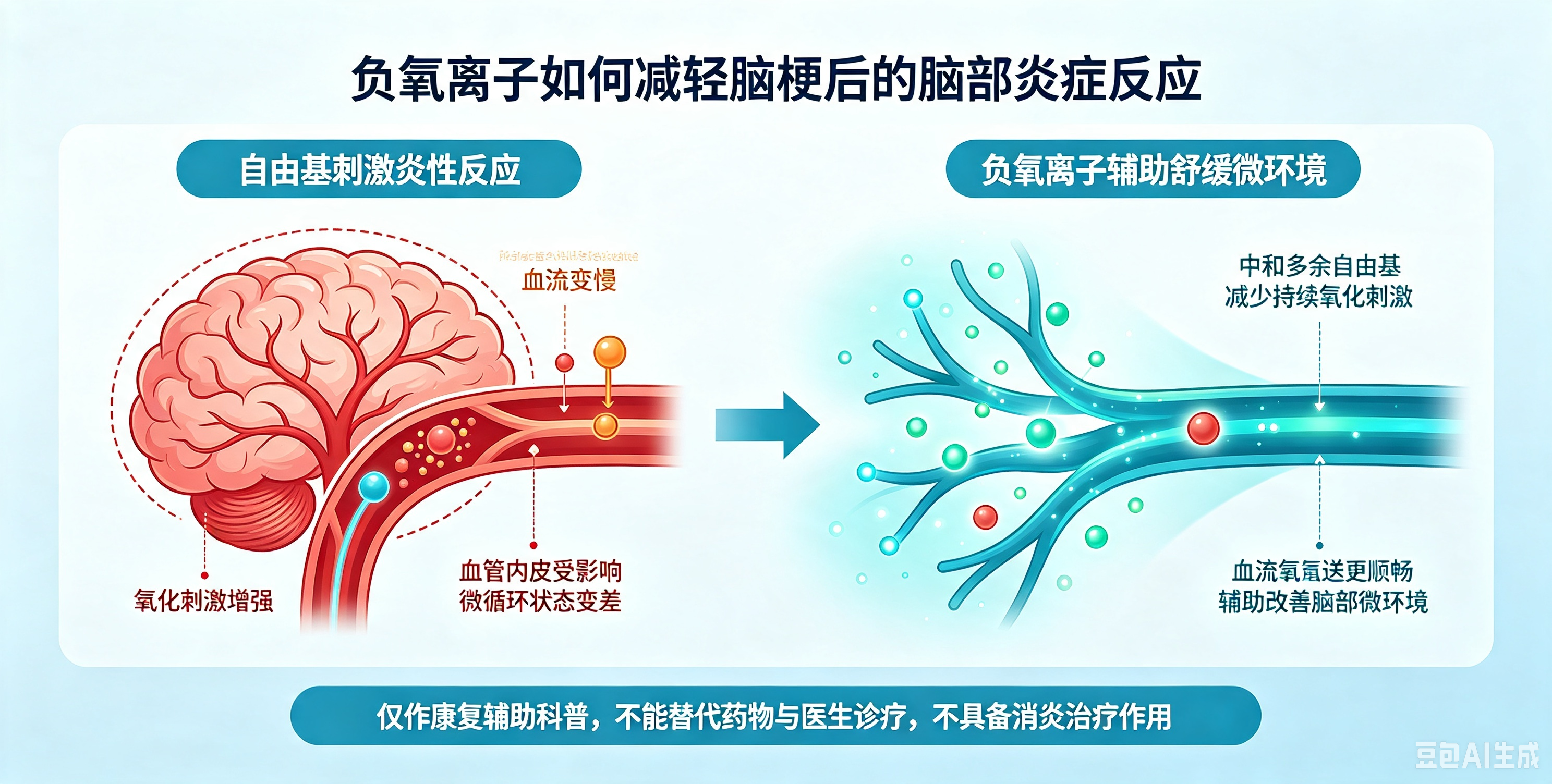 负氧离子如何减轻脑梗后的脑部炎症反应?